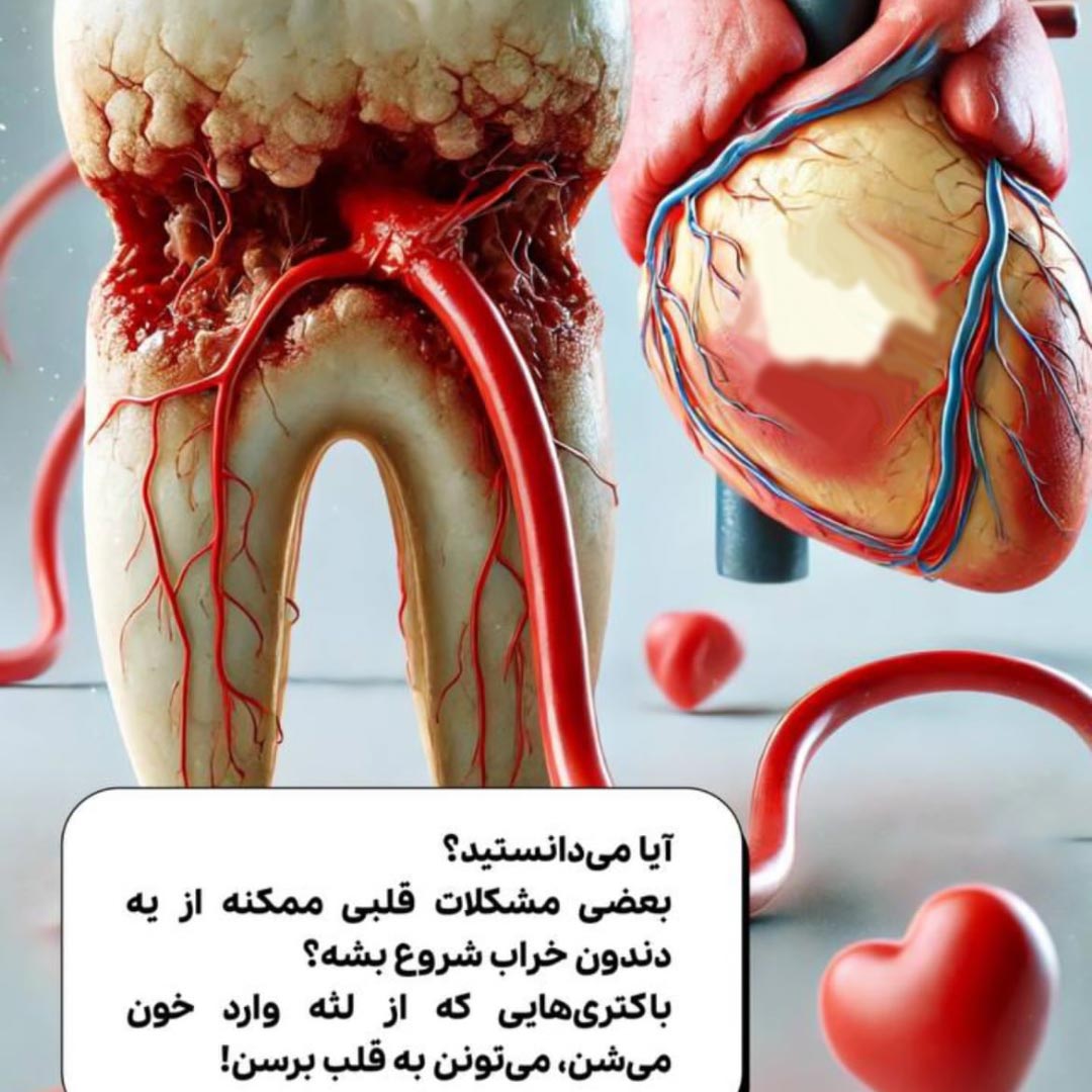 آیا دندون خراب باعث بیماری قلبی می شود ؟