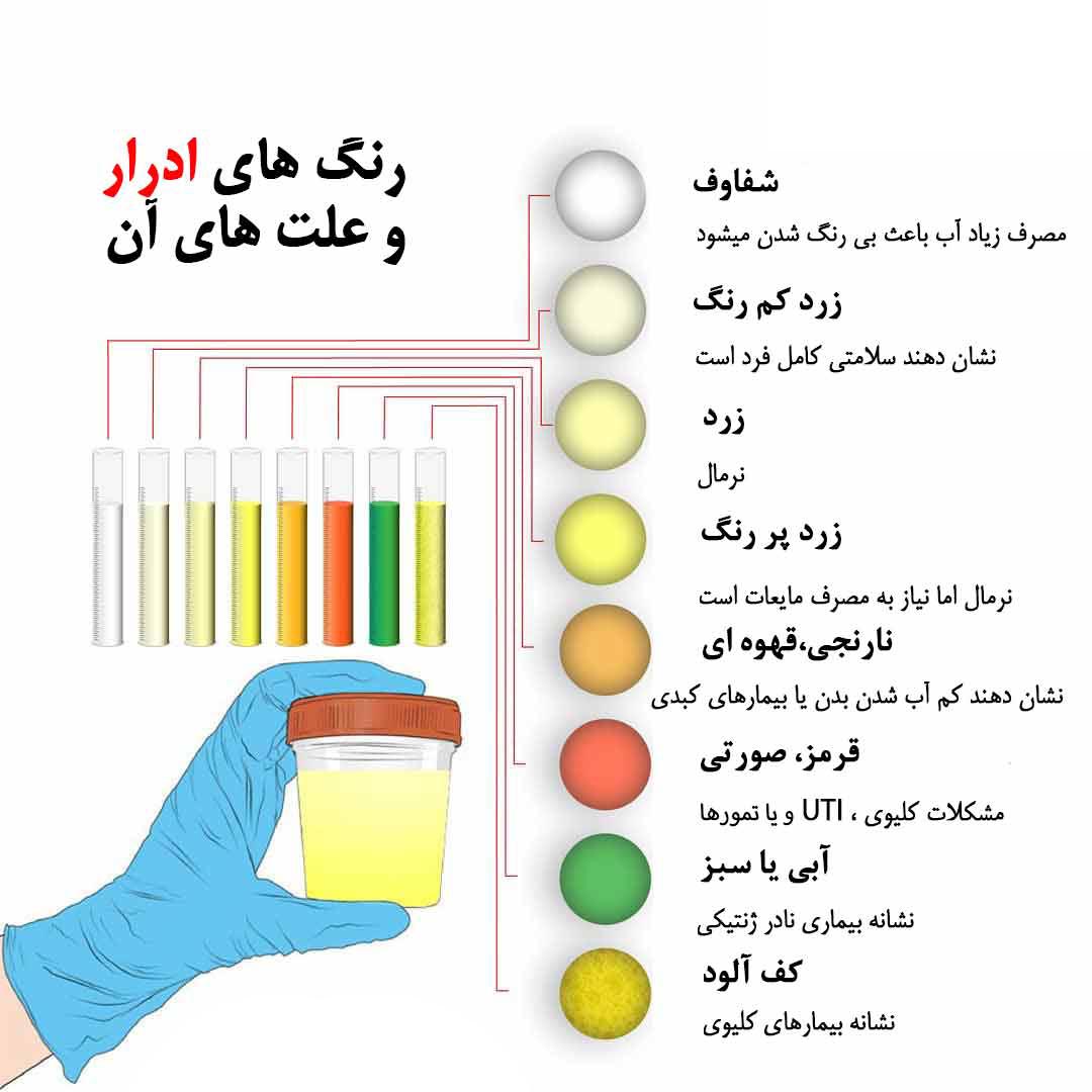 ادرار به رنگ چای نشانه چیست ؟