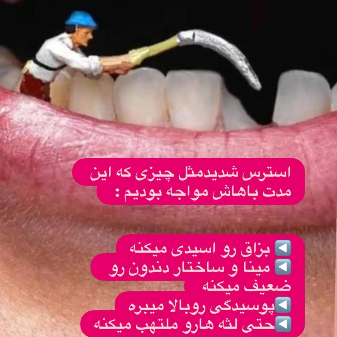 استرس چه رابطه ای با علت دندان قروچه دارد ؟