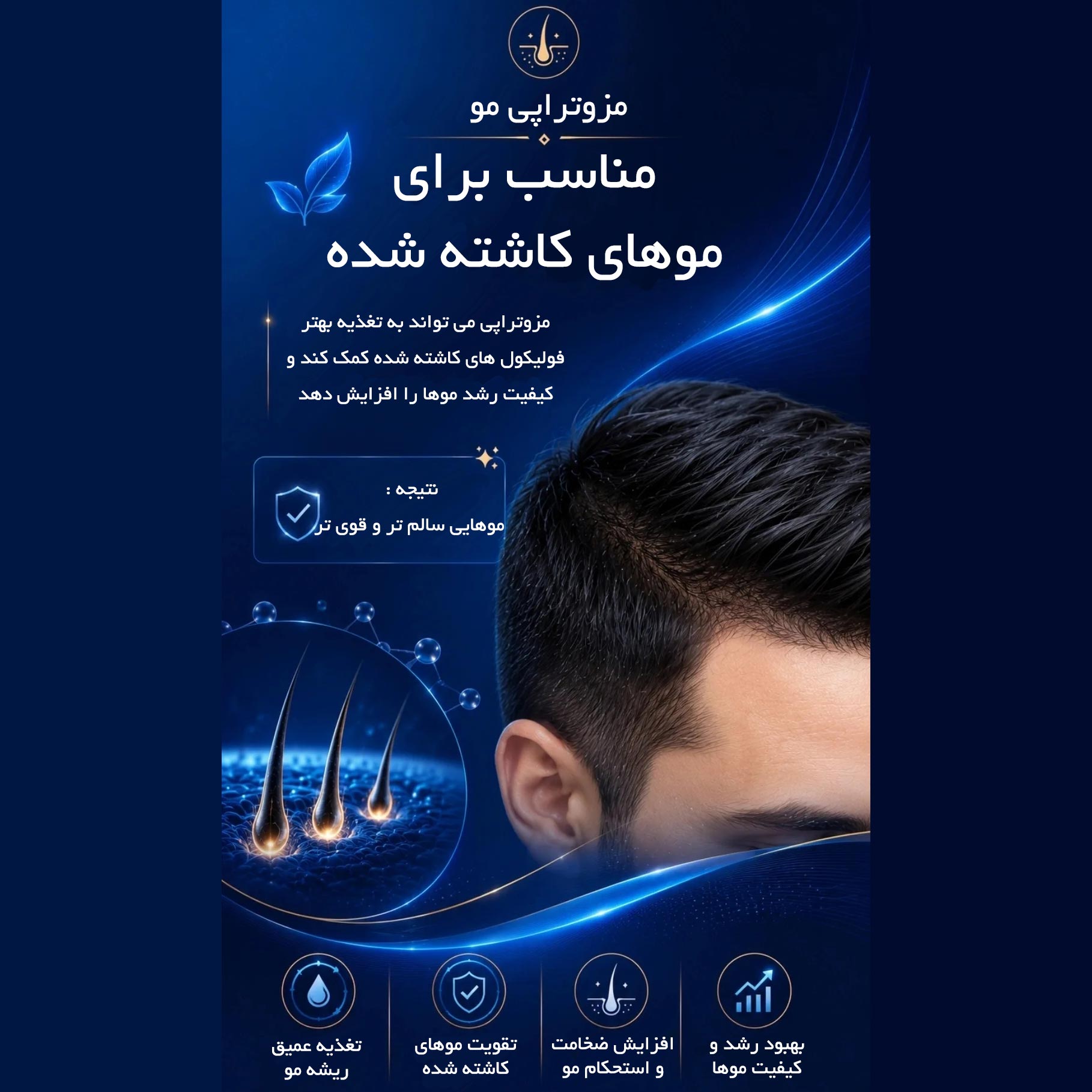 برای تقویت موهای کاشته شده بعد از کاشت مو چی مصرف کنیم ؟