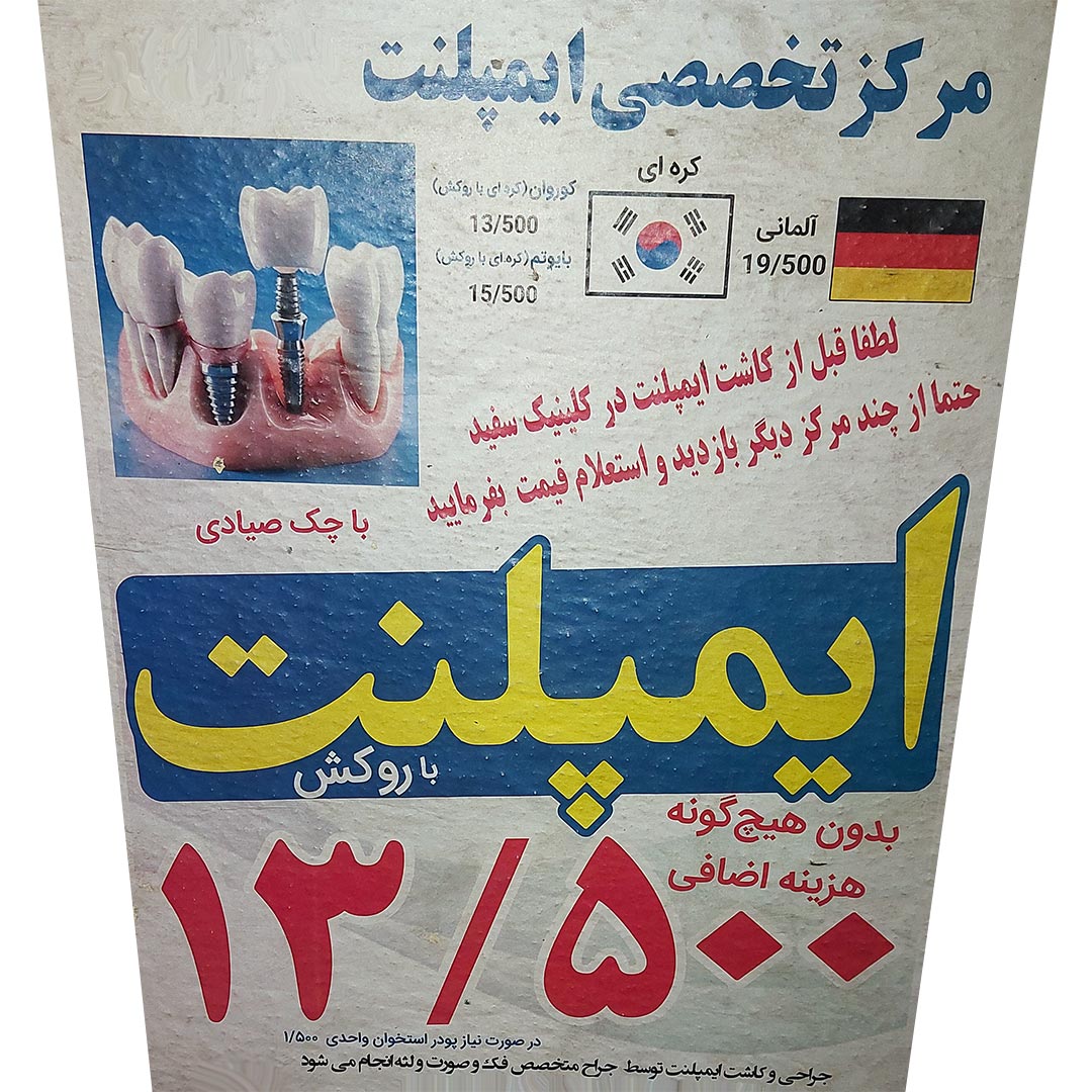 بهترین دکتر ایمپلنت در تهران