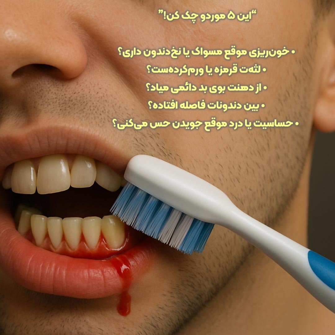 تست خانگی بیماری های لثه