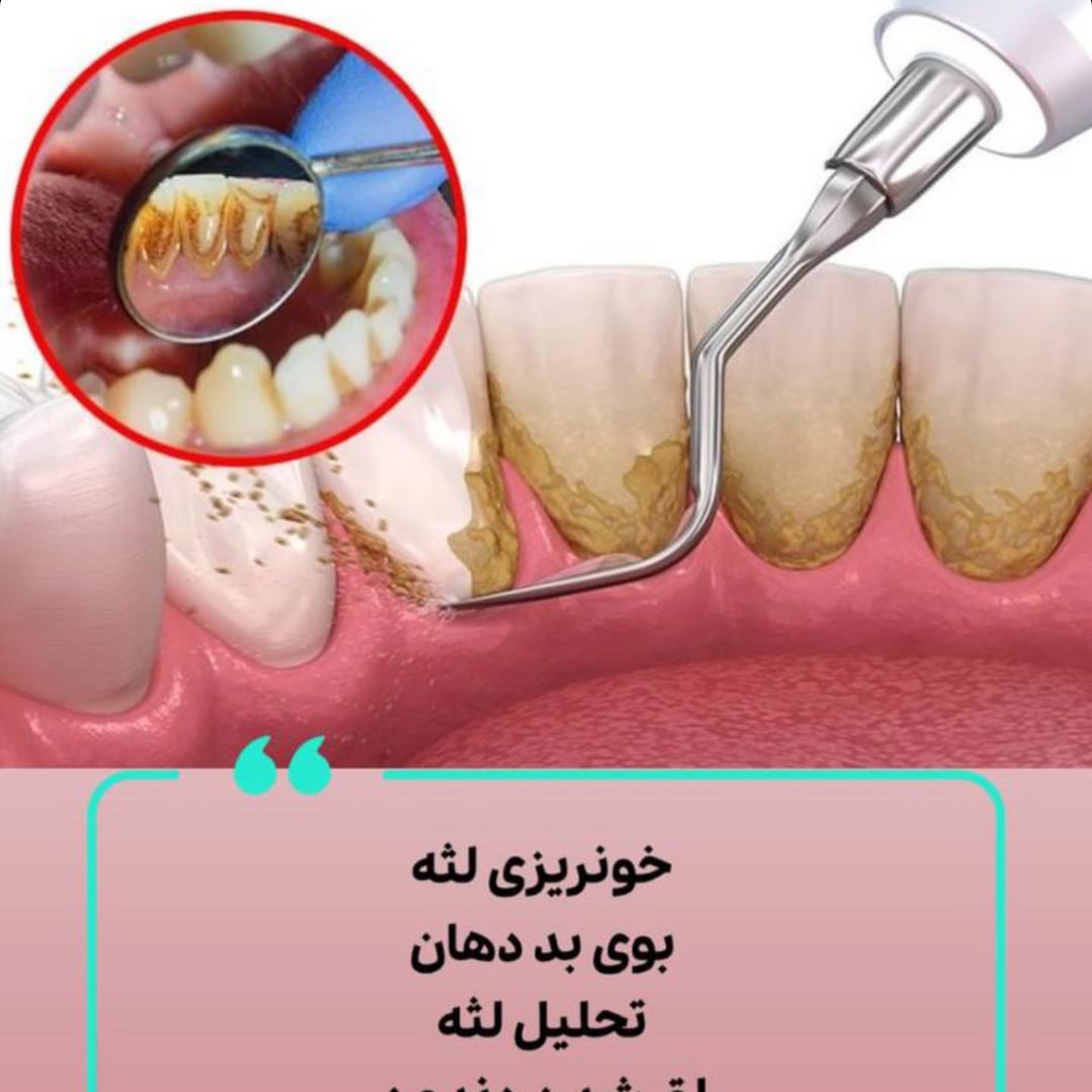 جرم دندون اون دشمن پنهان
