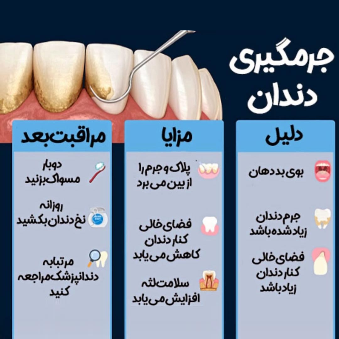 جرمگیری دندان + دلیل و مزایا و مراقبت بعد