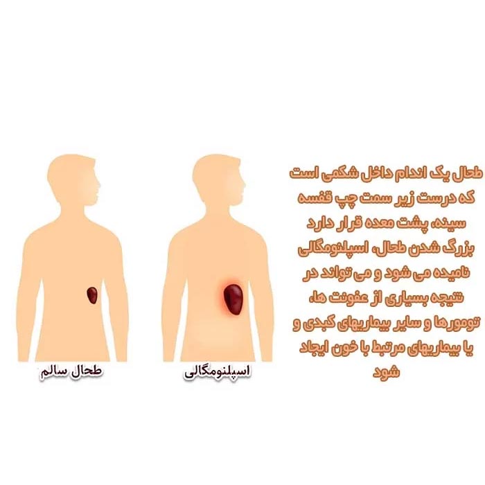 درد طحال کجاست