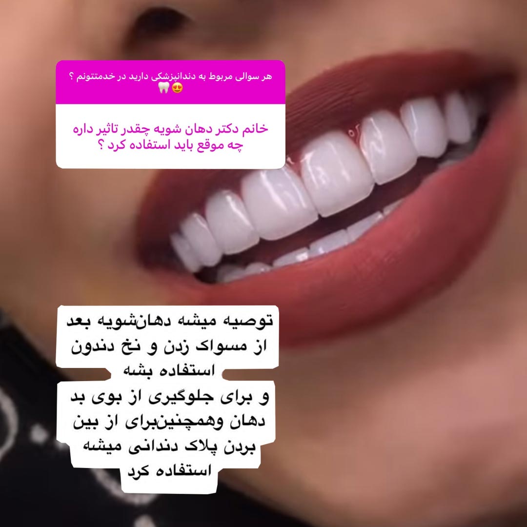 دهان شویه چه موقع باید استفاده کرد ؟ چقدر تاثیر داره ؟
