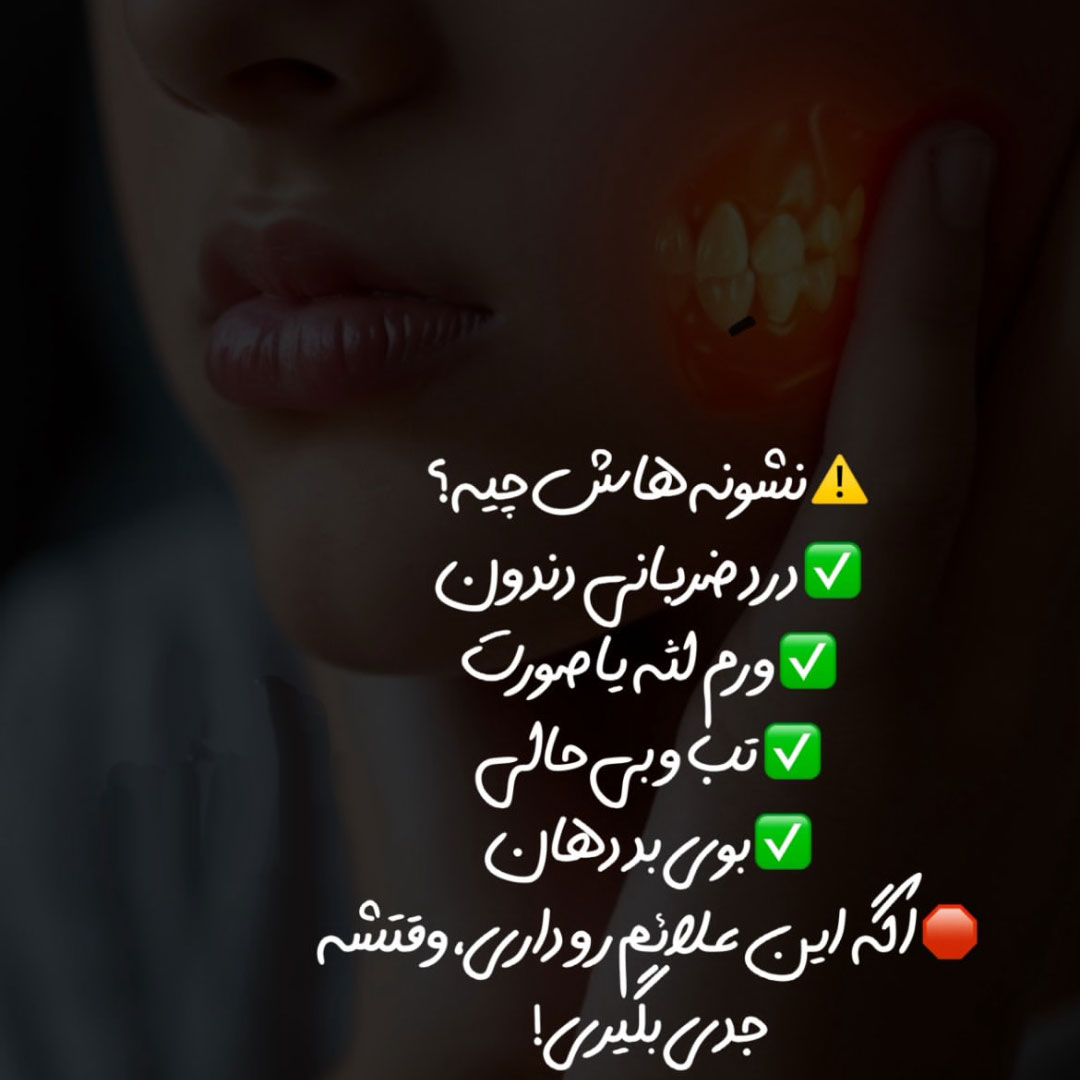 روش ترکاندن آبسه دندان در خانه + چگونه آبسه دندان را بترکانیم