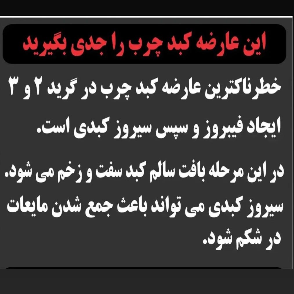 سیروز کبدی باعث جمع شدن مایعات در شکم