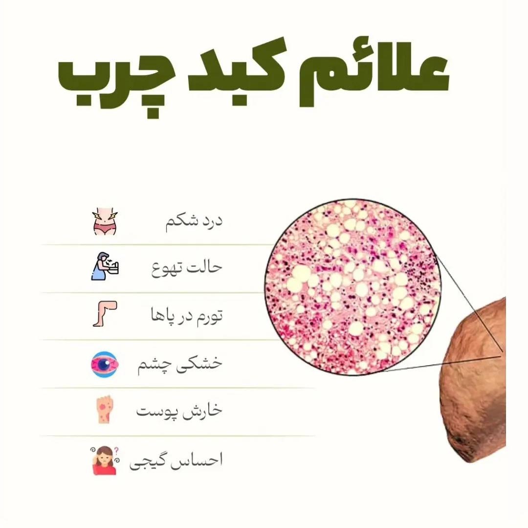 شش تا از مهمترین علائم کبد چرب