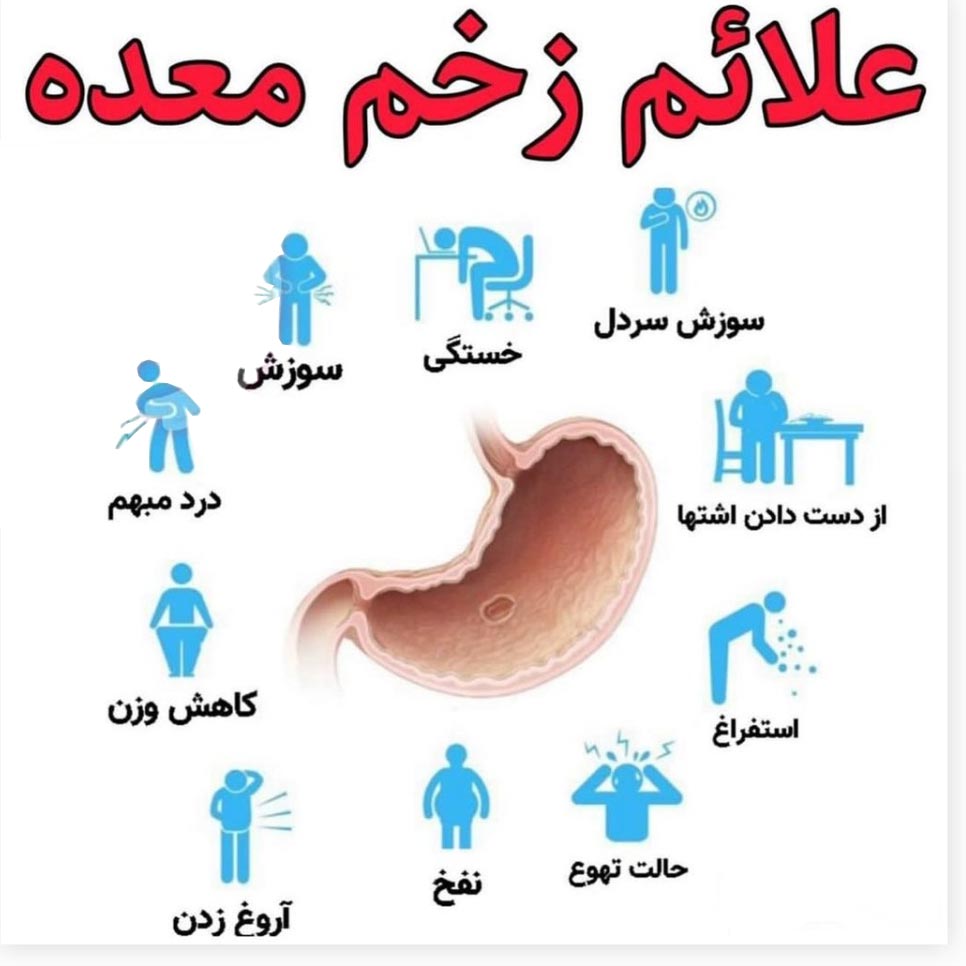 علائم زخم معده 10 مورد اصلی