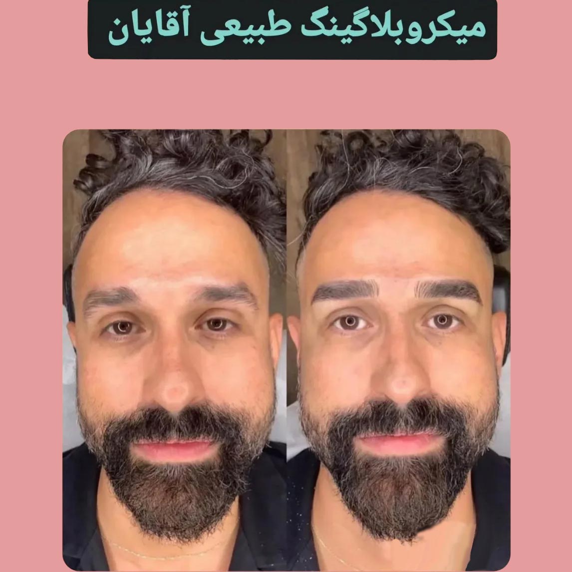 عکس میکرو ابرو قبل و بعد