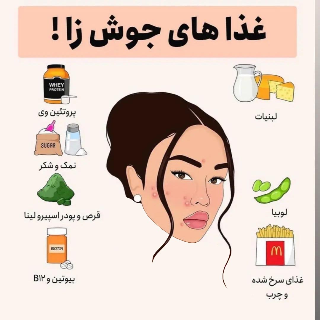 غذا های جوش زا چی هستند ؟