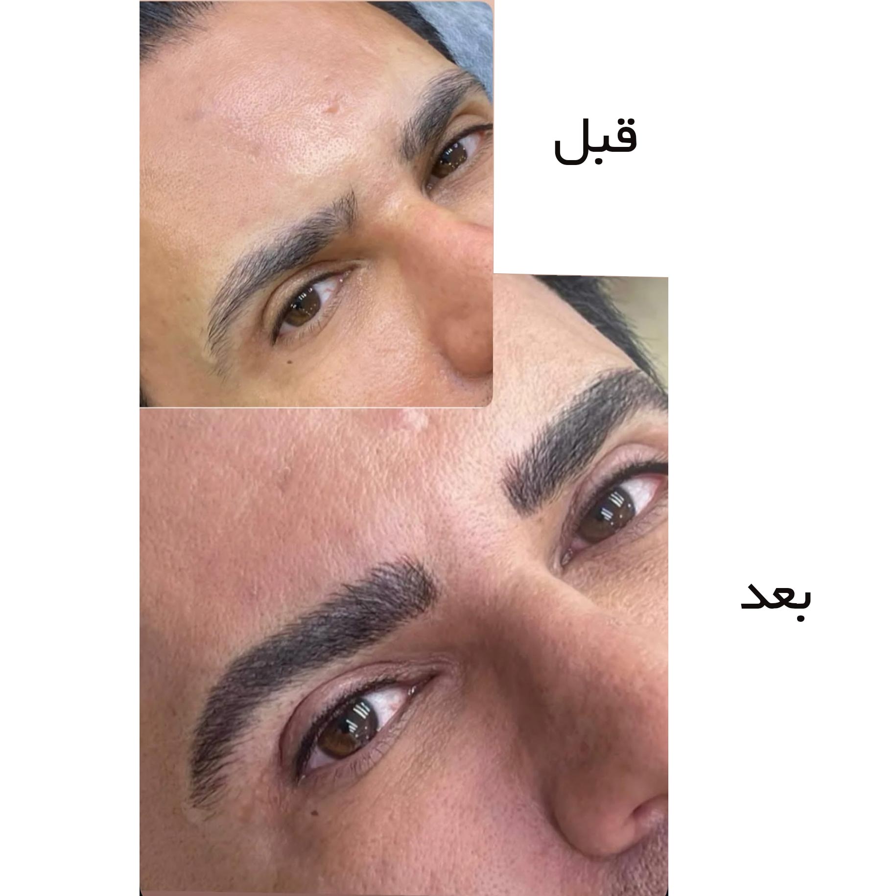 فرق فیبروز ابرو با میکروبلیدینگ