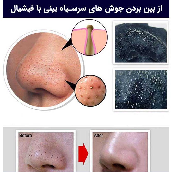 فیشال یا فیشیال