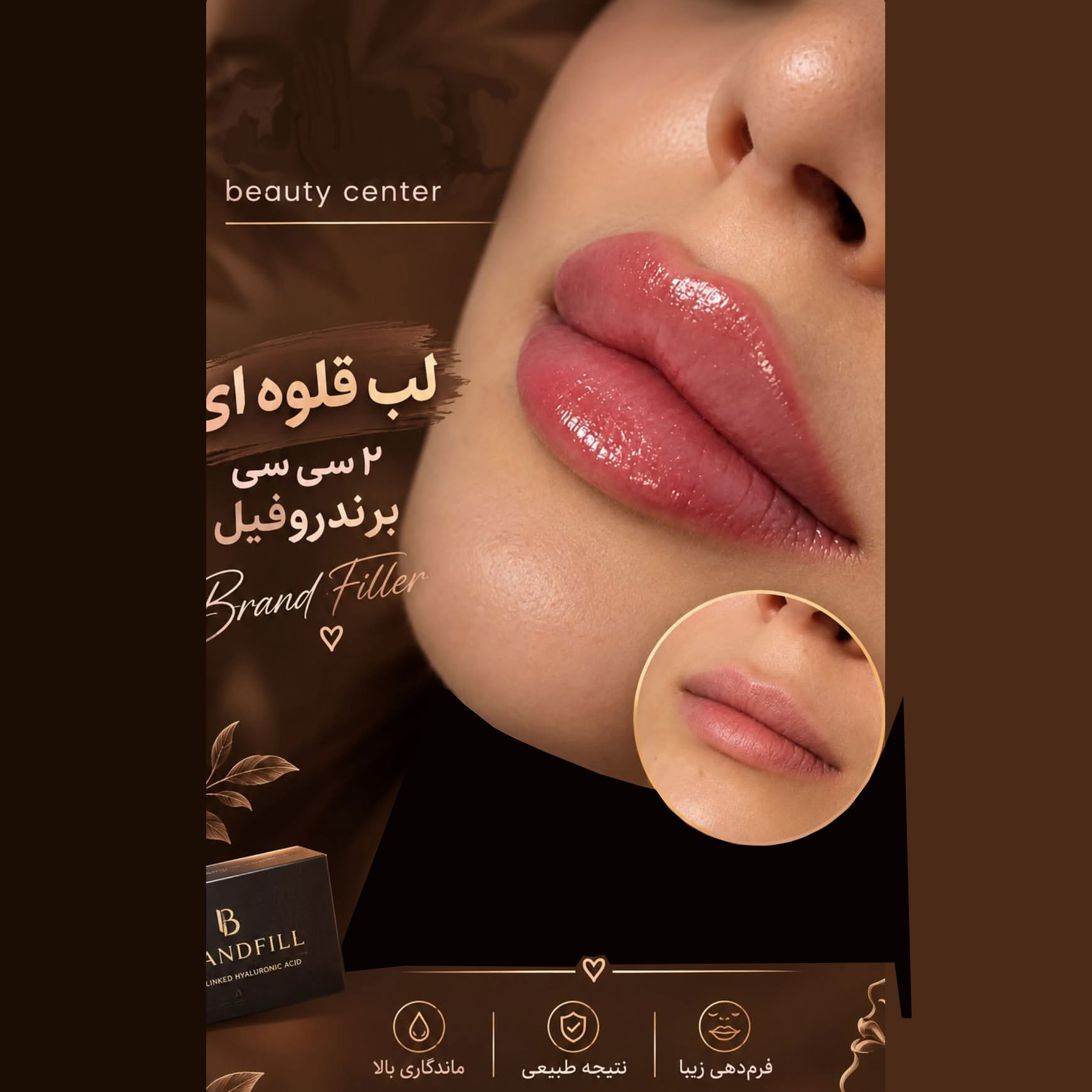 فیلر لب قلوه ای با حجم دو سی سی برند روفیل