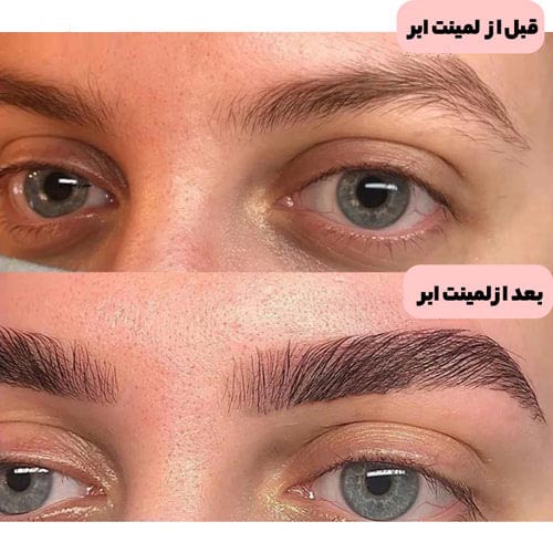لیفت ابرو در خانه
