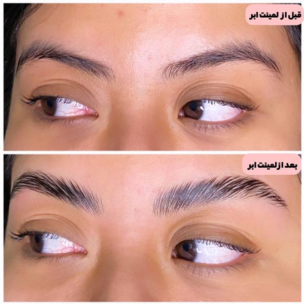 لیفت ابرو قبل و بعد + قیمت در آرایشگاه
