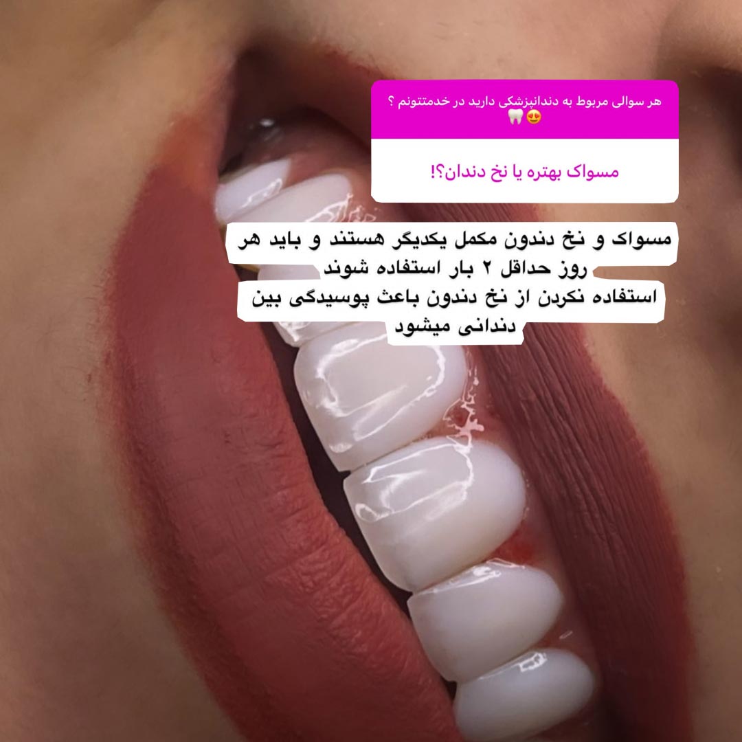 مسواک بهتره یا نخ دندان ؟
