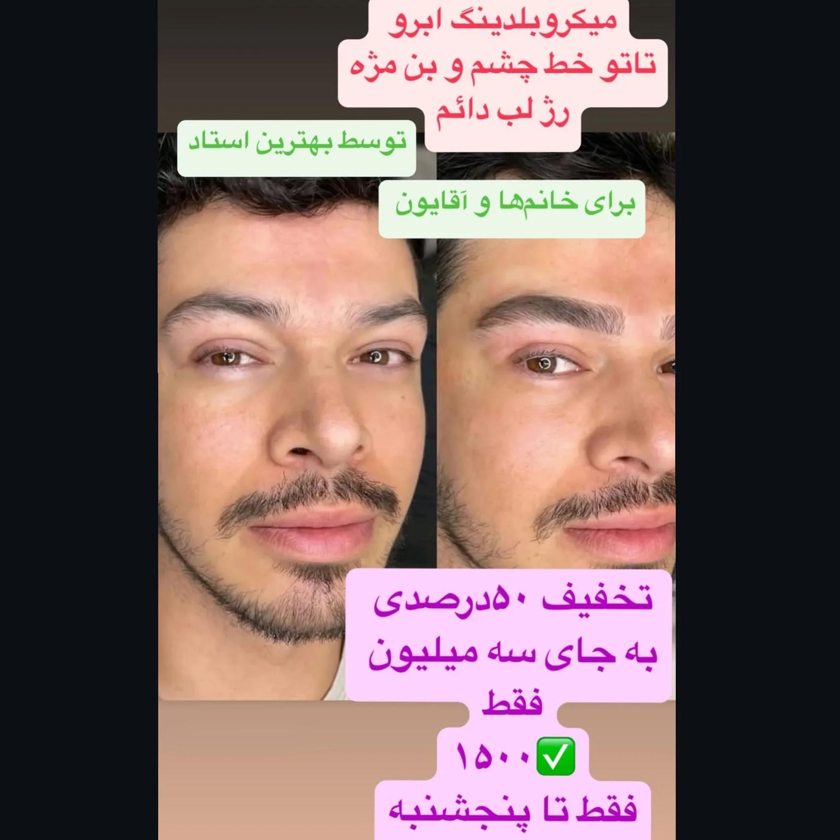 میکروبلدینگ ابرو آقا با تخفیف 50 درصدی