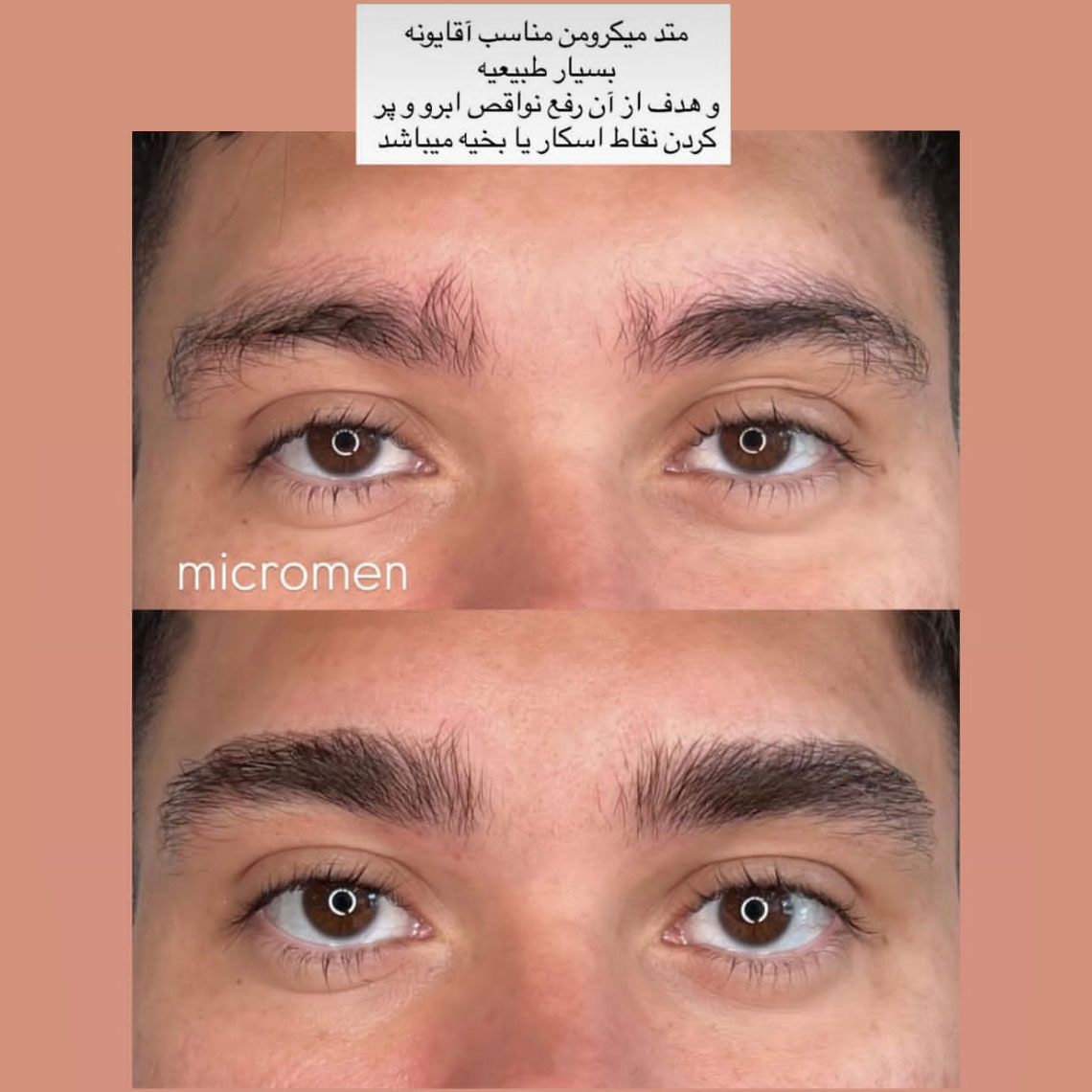 پرپشت کردن ابرو با میکروبلیدینگ و فیبروز تفاوتشان چیست ؟