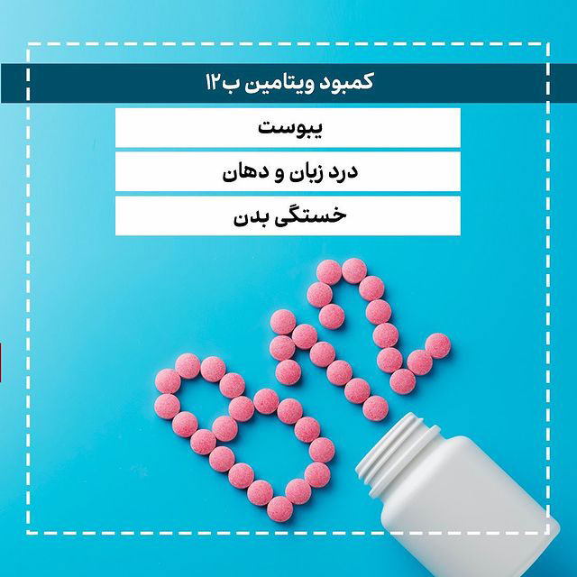 کمبود ویتامین ب12 و ارتباط با یبوست درد زبان و دهان خستگی بدن